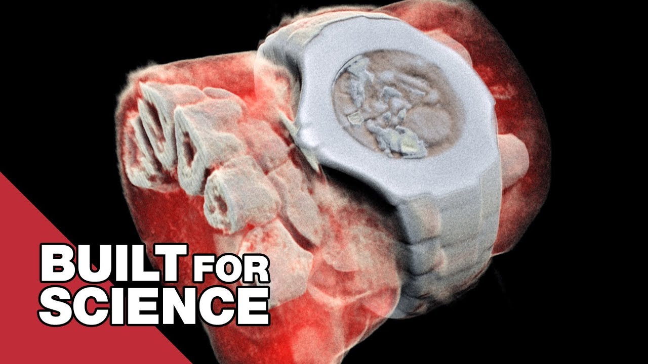 Take a Look at the World’s First Coloured 3D X-Ray